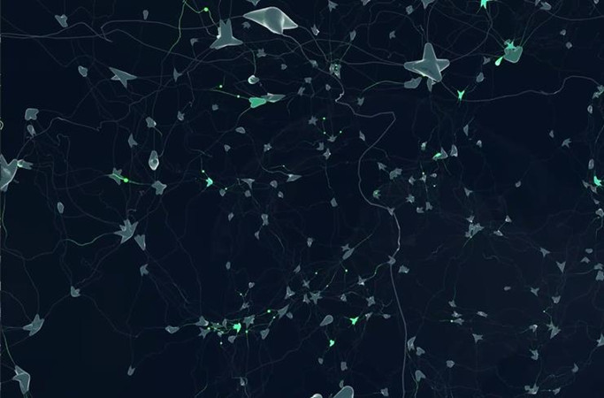 探索“神经元森林”——3D立体技术呈现结构变化