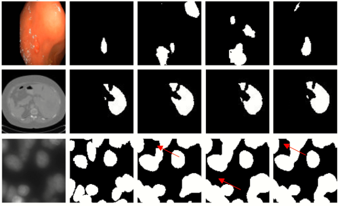 细胞细菌识别检测算法计算机视觉设备开发