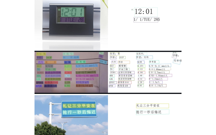 人工智能-AI識別算法軟件開發(fā)
